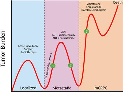 Personalized Medicine for Prostate Cancer: Is Targeting Metabolism a Reality?